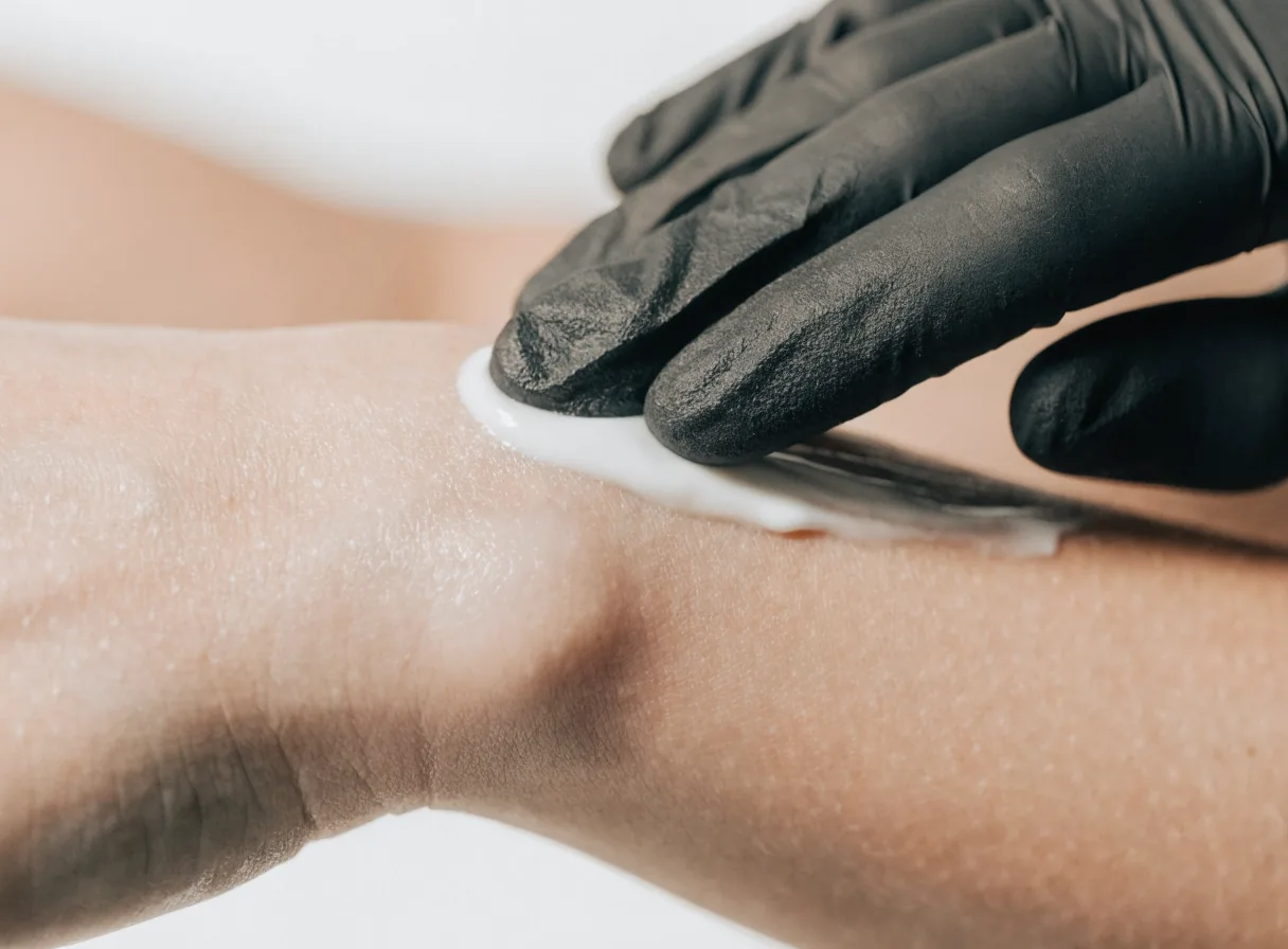 A gloved hand smoothing a layer of numbing cream onto a bare forearm